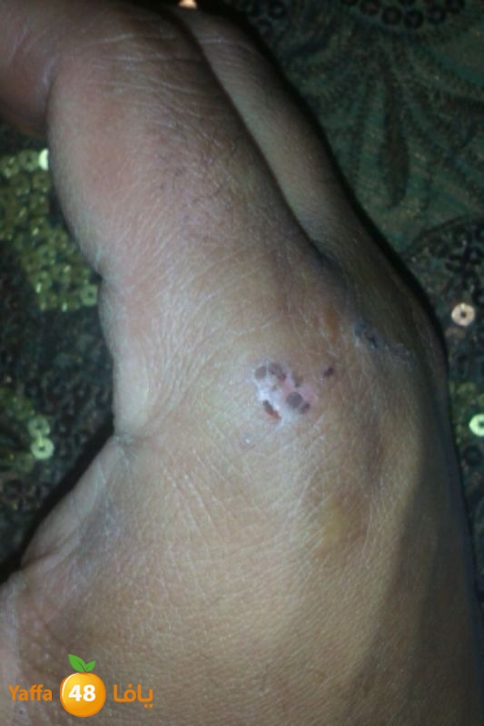 phoneludinjury (5).JPG